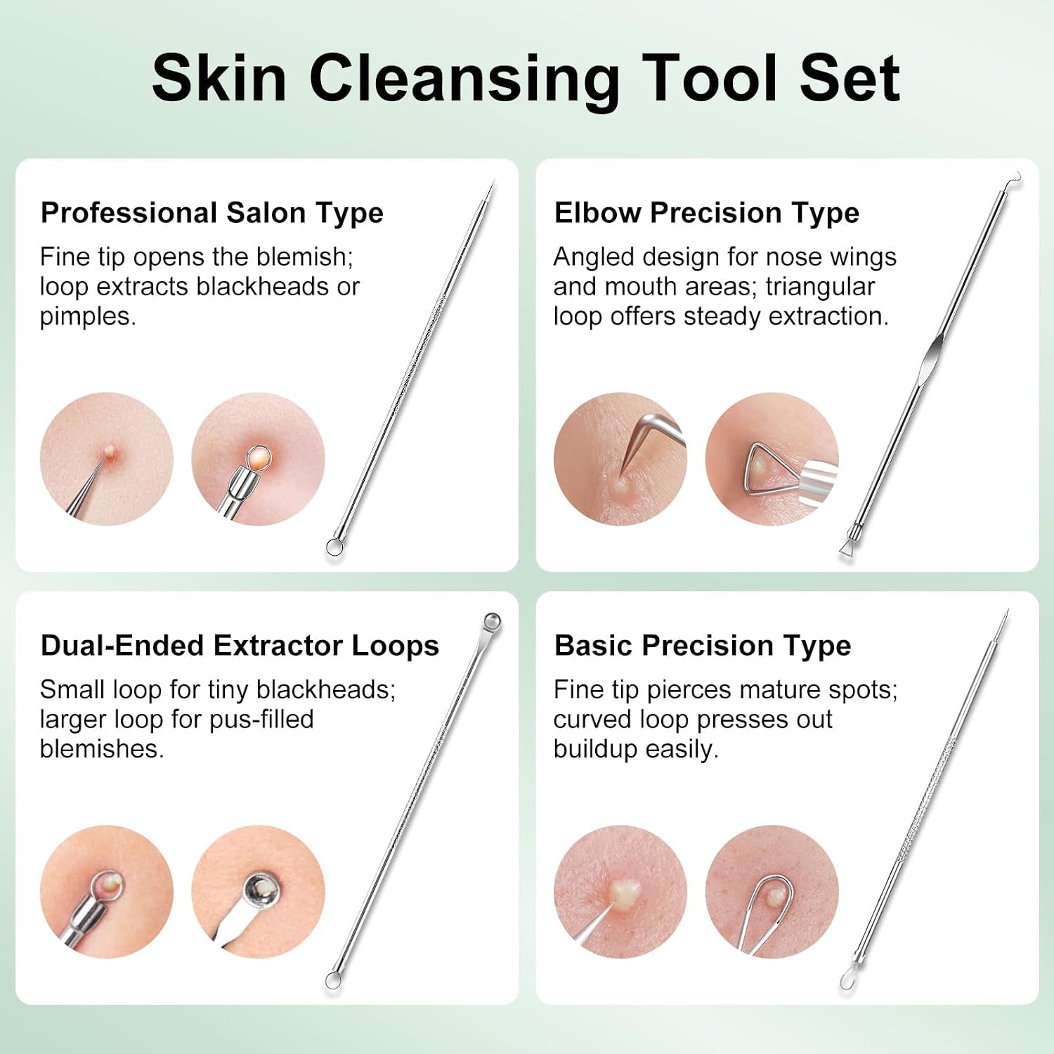 Blackhead Remover Kit – Stainless Steel Pore Extractor Set