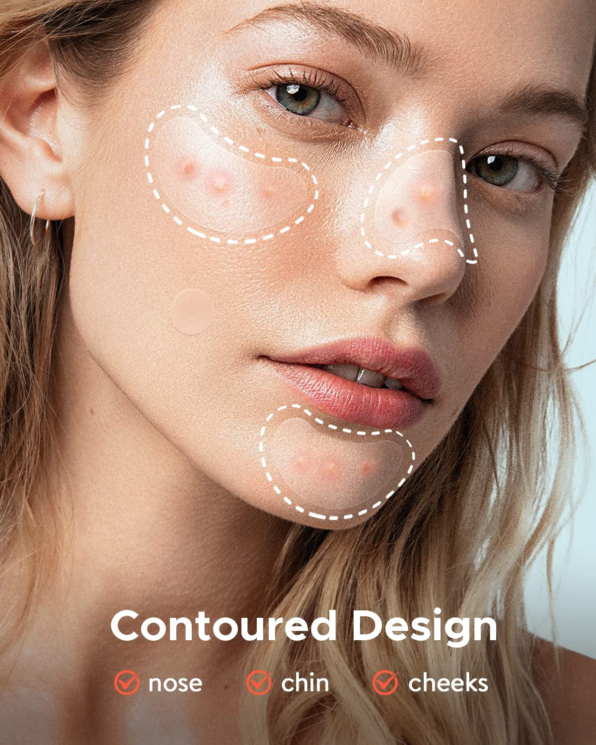 Large Hydrocolloid Acne Patches – Tea Tree Pimple Patches